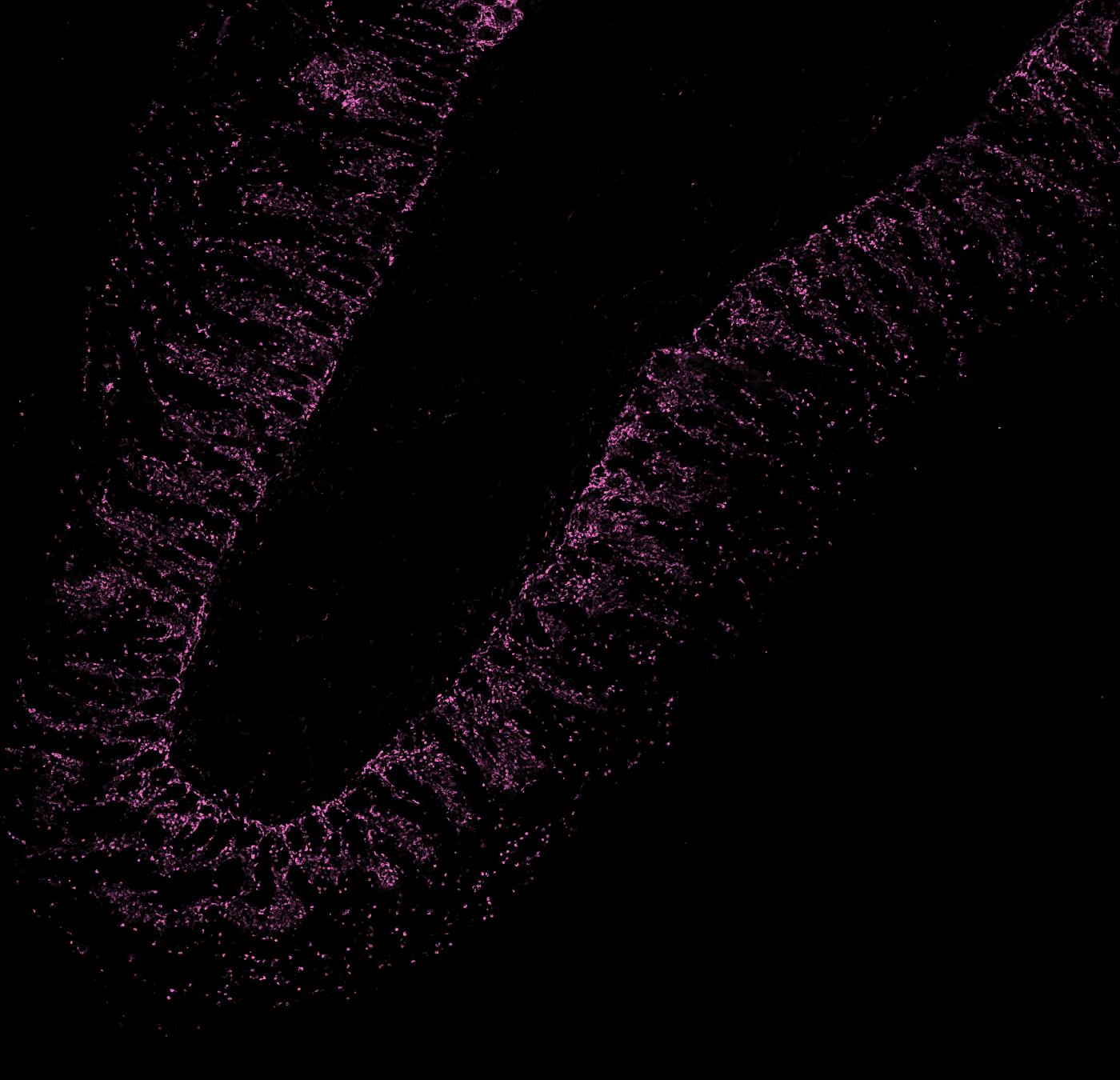 The section with CD45 in colour.