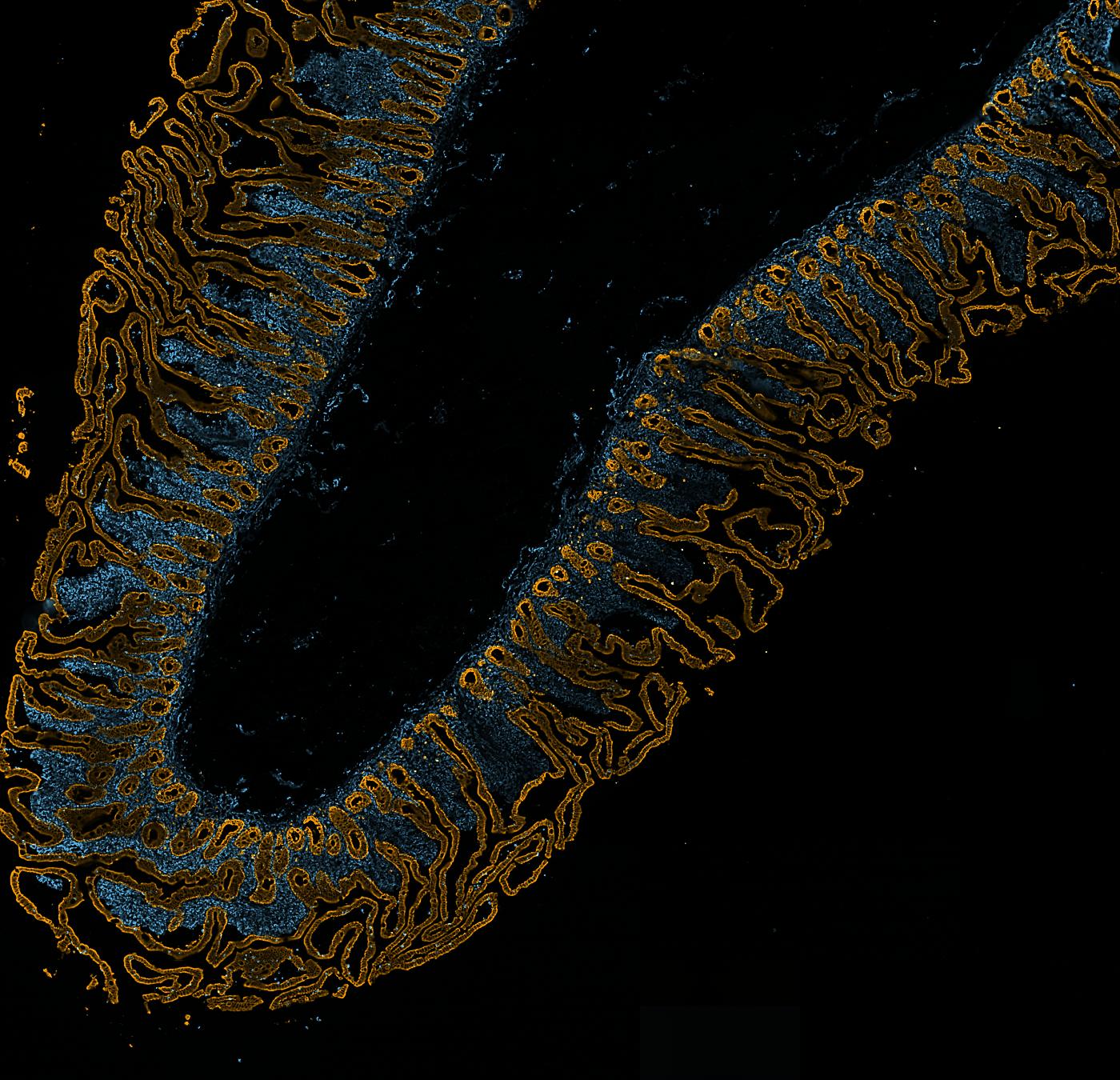 The section with Cytokeratin and Vimentin in colour.