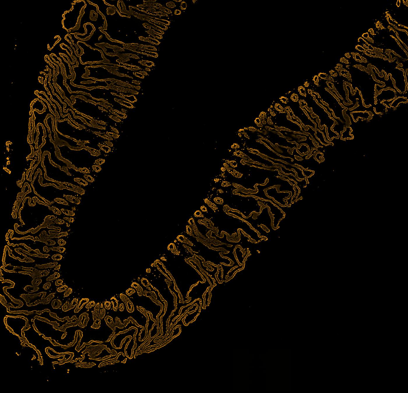 The section with Cytokeratin in colour.