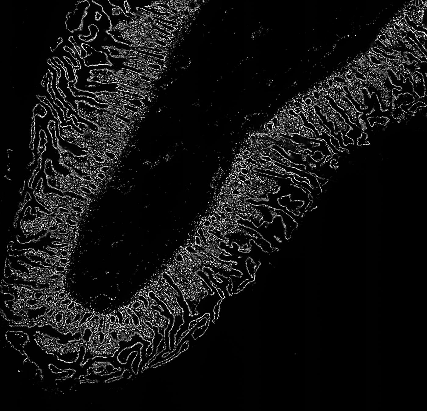 The section in grey, by its nuclear stain, Hoechst.