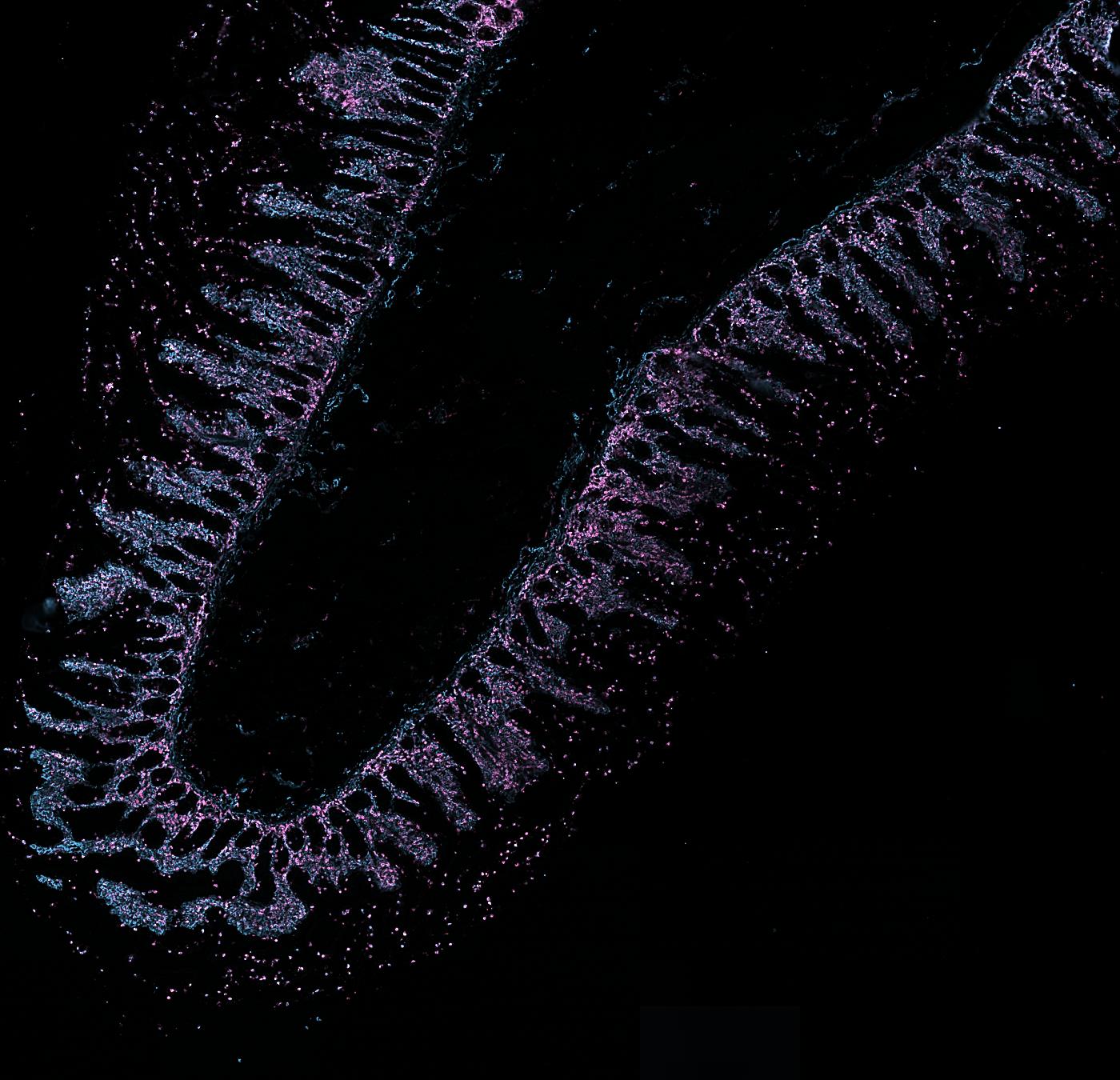 The section with Vimentin and CD45 in colour.