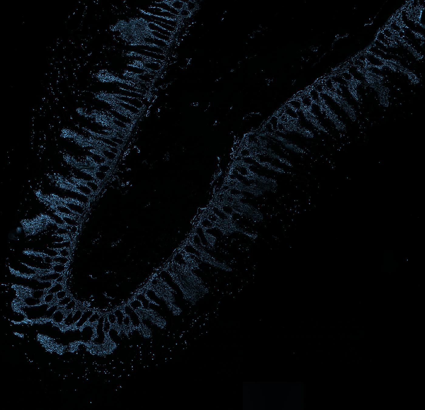 The section with Vimentin in colour.