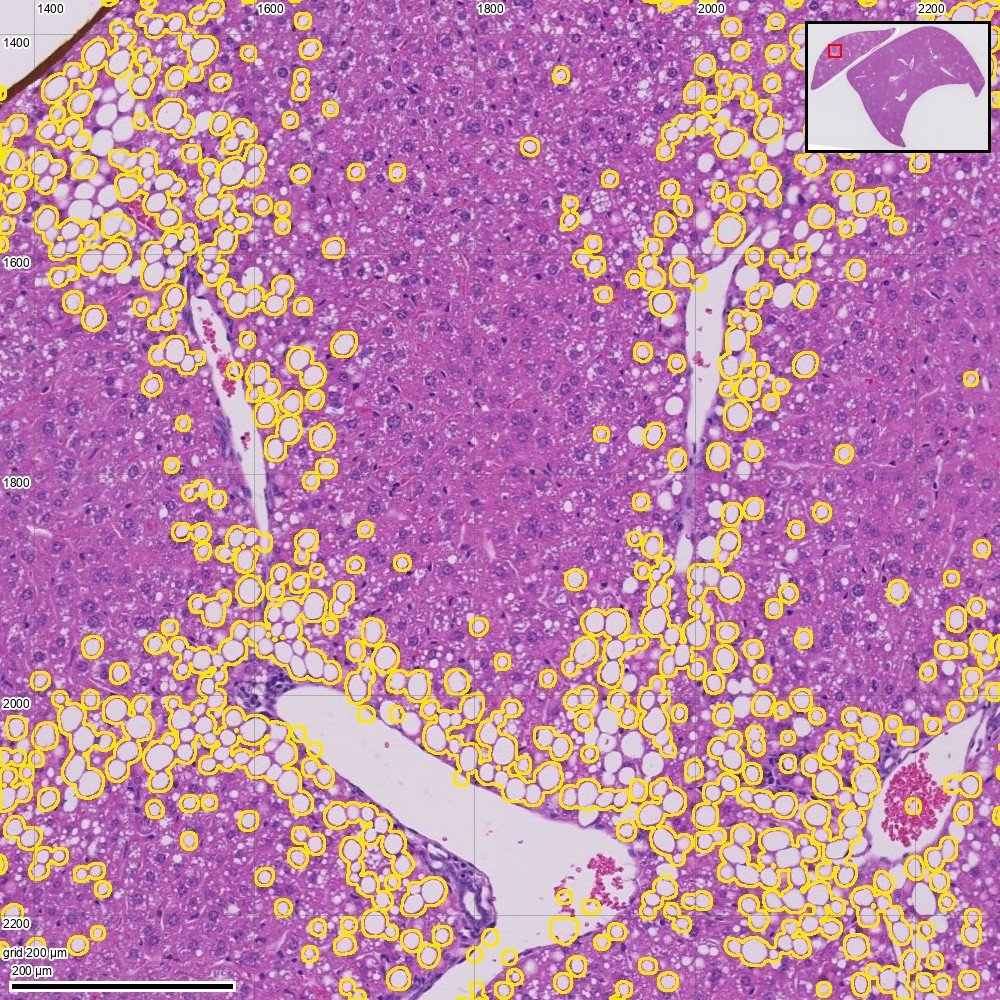 Fatty mouse liver with each fat droplet outlined in orange.