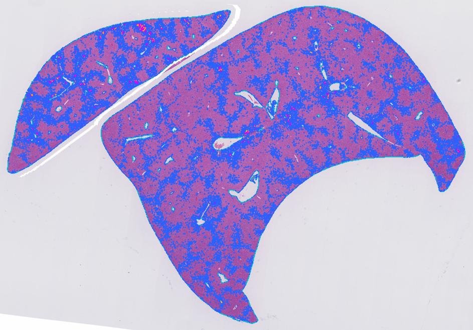Two lobes of a fatty mouse liver, with the steatotic area outlined in blue.