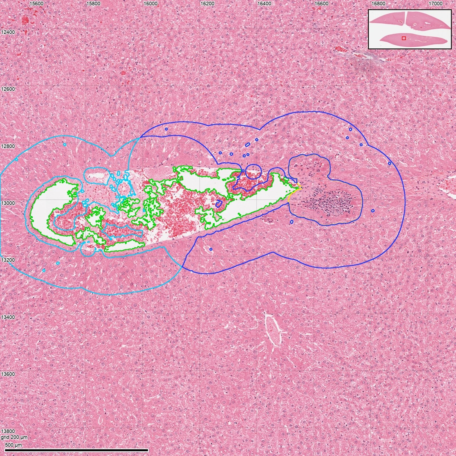 A liver vein with the zones around it outlined in green and blue.