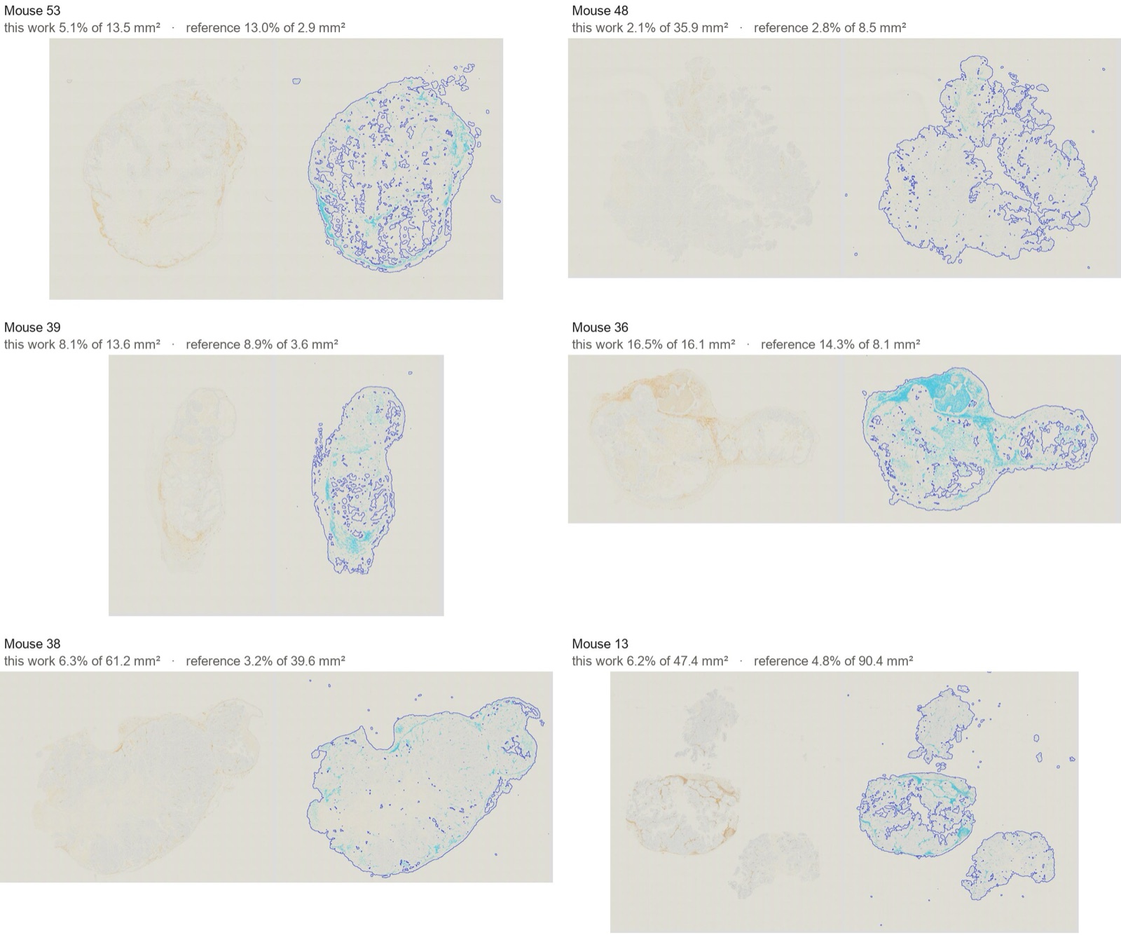 Six slides, each beside the same slide with our tissue outline and positive pixels, with both analyses' numbers above each pair.